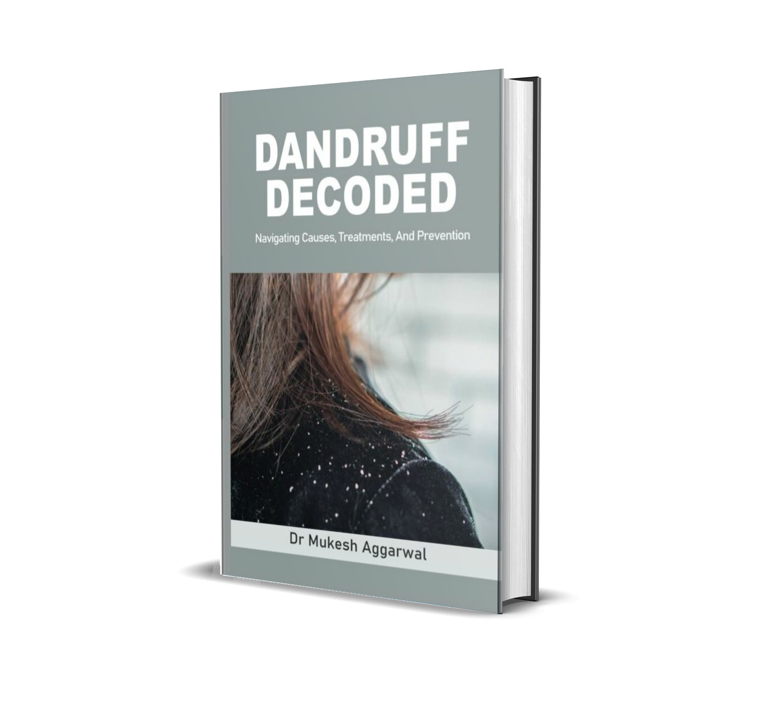 Dandruff Decoded: Navigating Causes, Treatments and Prevention