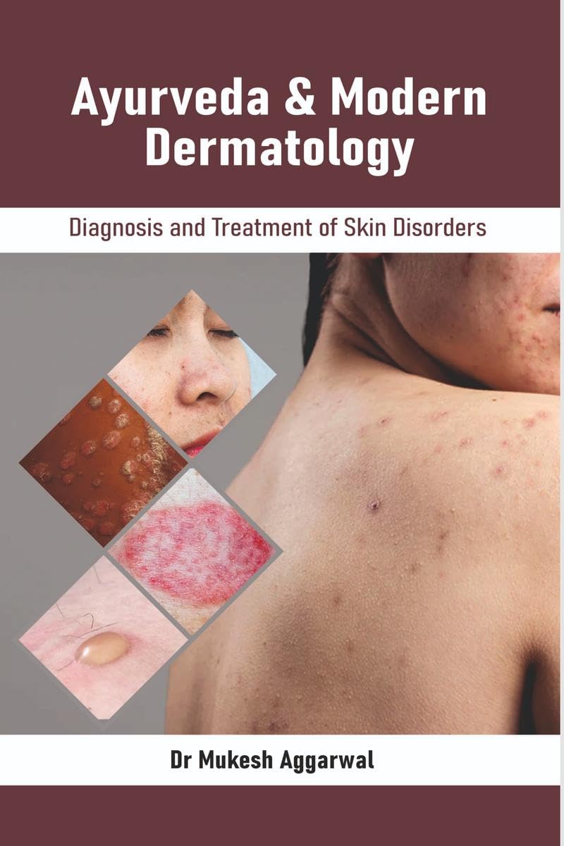 Ayurveda & Modern Dermatology : Diagnosis and Treatment of Skin