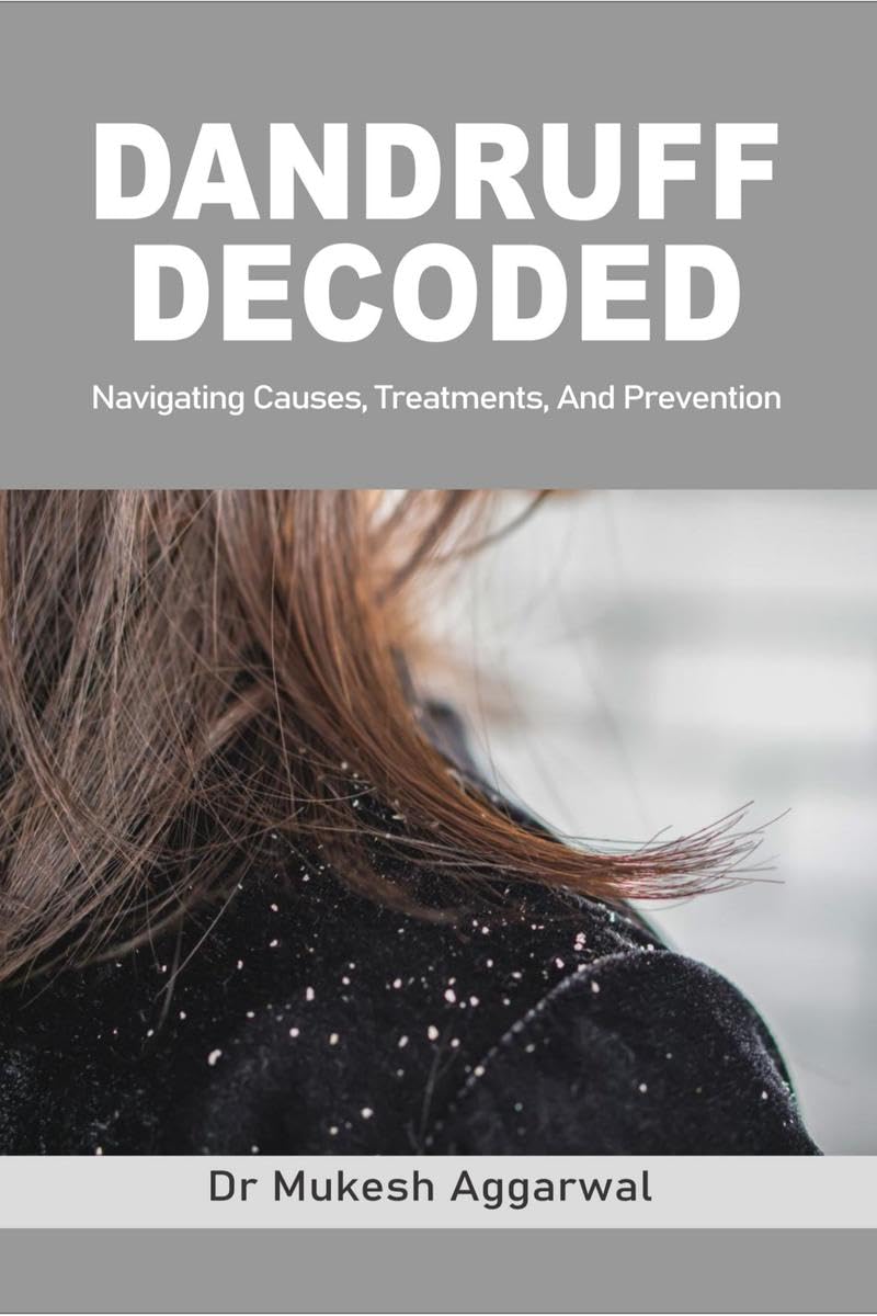 Dandruff Decoded: Navigating Causes, Treatments and Prevention