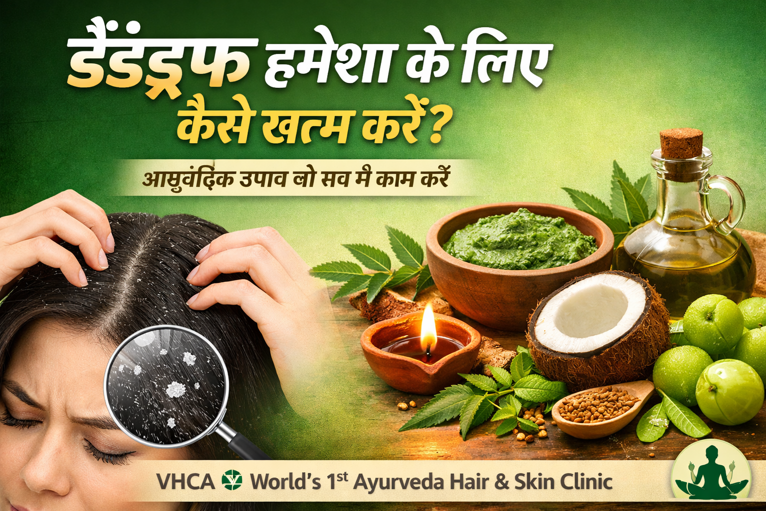 डैंड्रफ हमेशा के लिए कैसे खत्म करें? आयुर्वेदिक तरीके जो सच में काम करते हैं