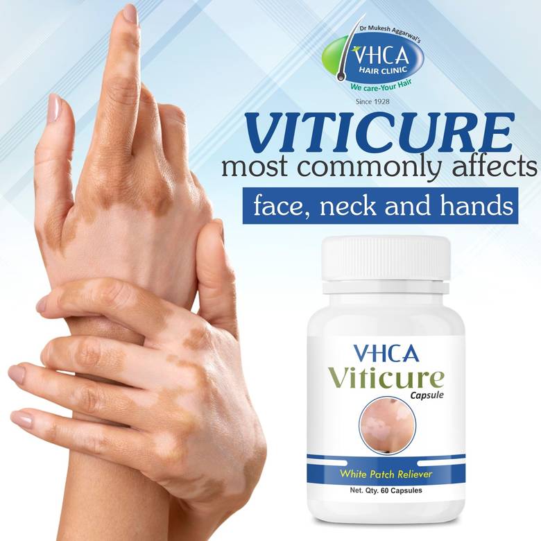 VHCA Viticure Capsule