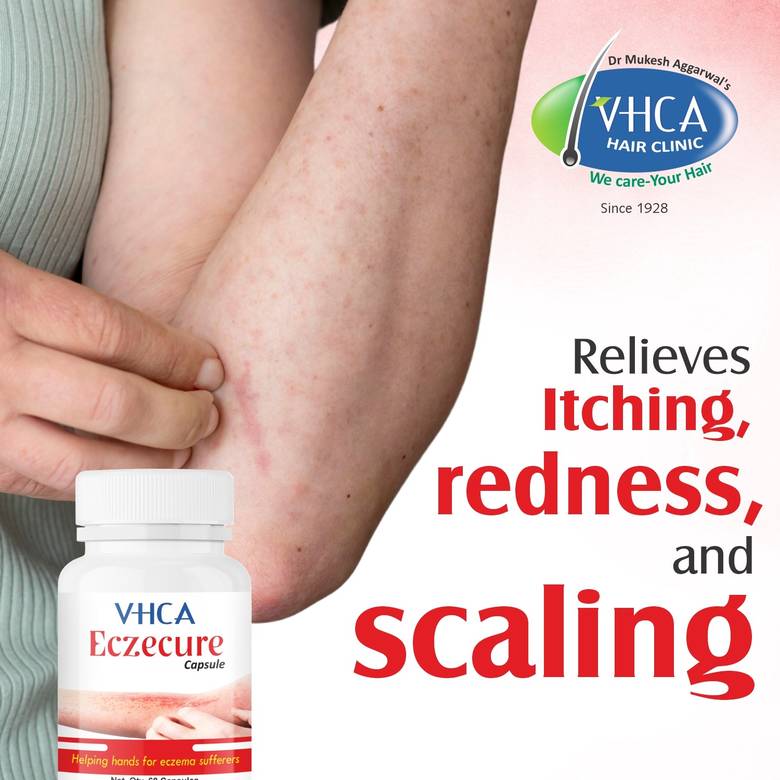 VHCA Eczecure capsule