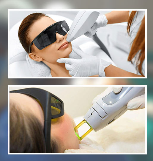LASER HAIR REMOVAL -